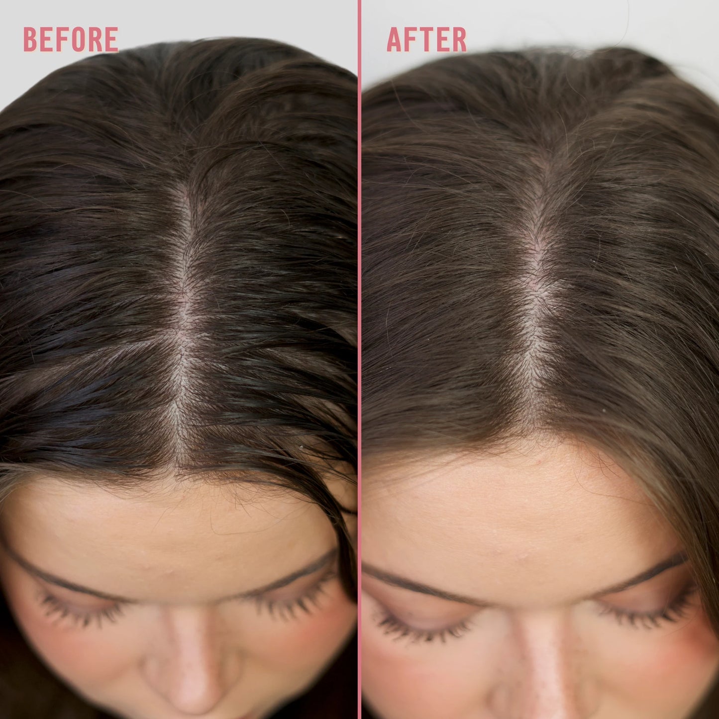 A split-screen close-up of a woman's hairline and part line, showing darker, fuller-looking hair on the right compared with thinner, lighter hair on the left.