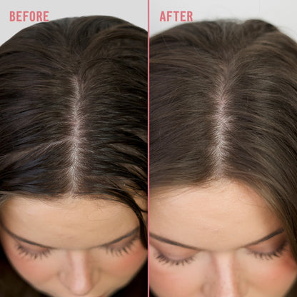 A split-screen close-up of a woman's hairline and part line, showing darker, fuller-looking hair on the right compared with thinner, lighter hair on the left.