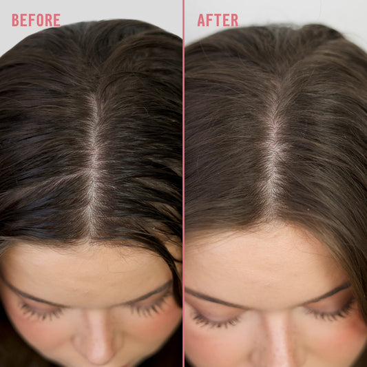 A split-screen close-up of a woman's hairline and part line, showing darker, fuller-looking hair on the right compared with thinner, lighter hair on the left.